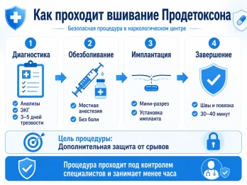 Имплантация Продетоксон в Азове